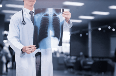 Doctor looking at a chest xray